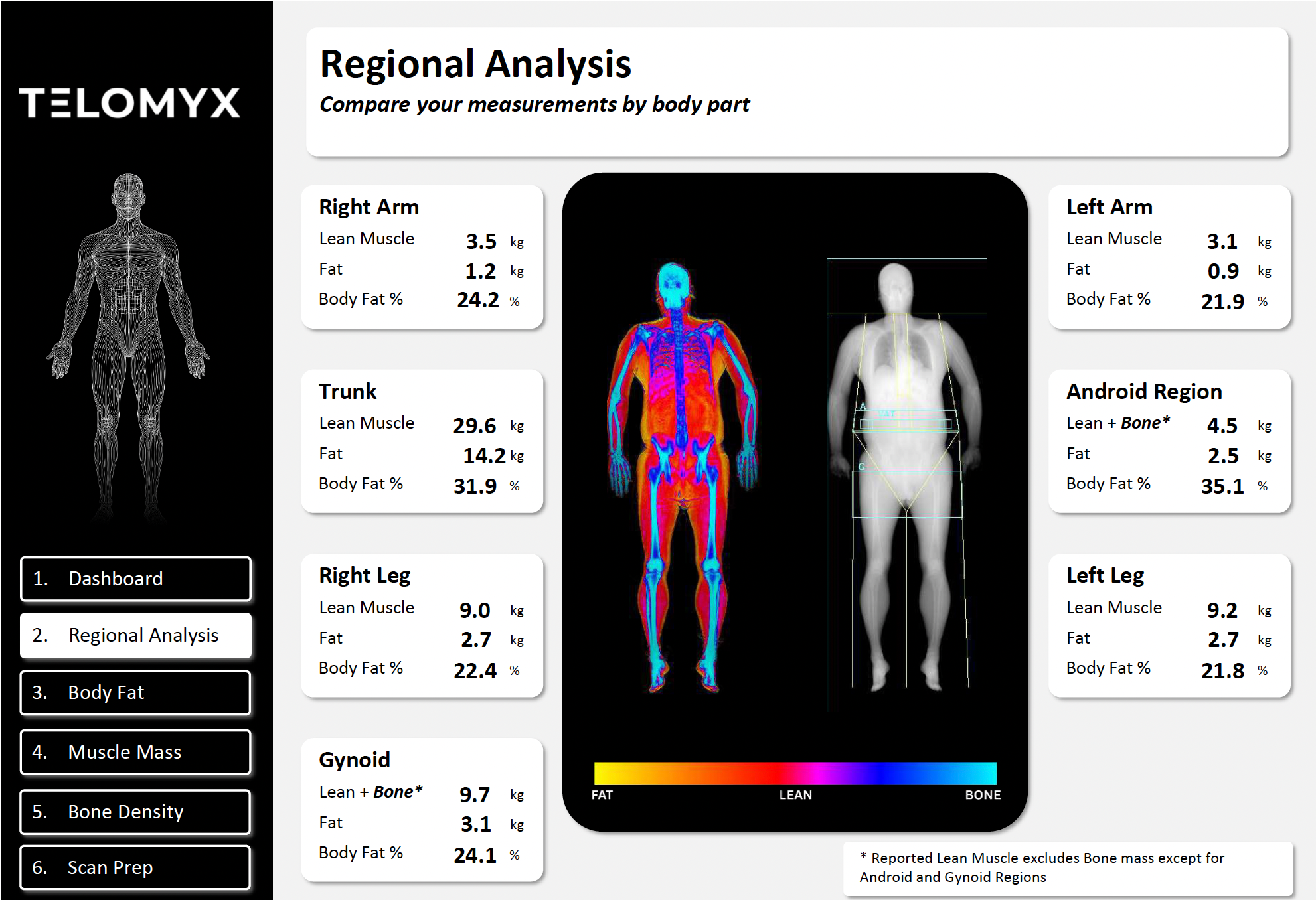 Telomyx DEXA Scan Report regional analysis for weight loss