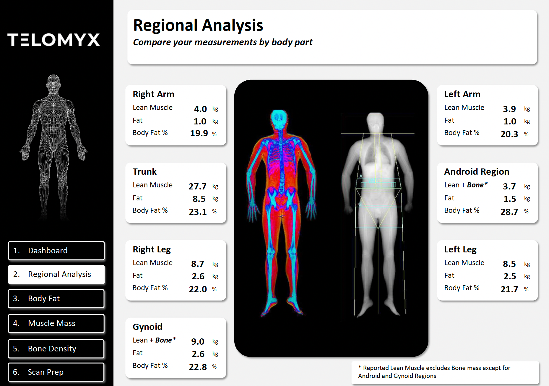 An image of the Regional Analysis section of the Telomyx DEXA report
