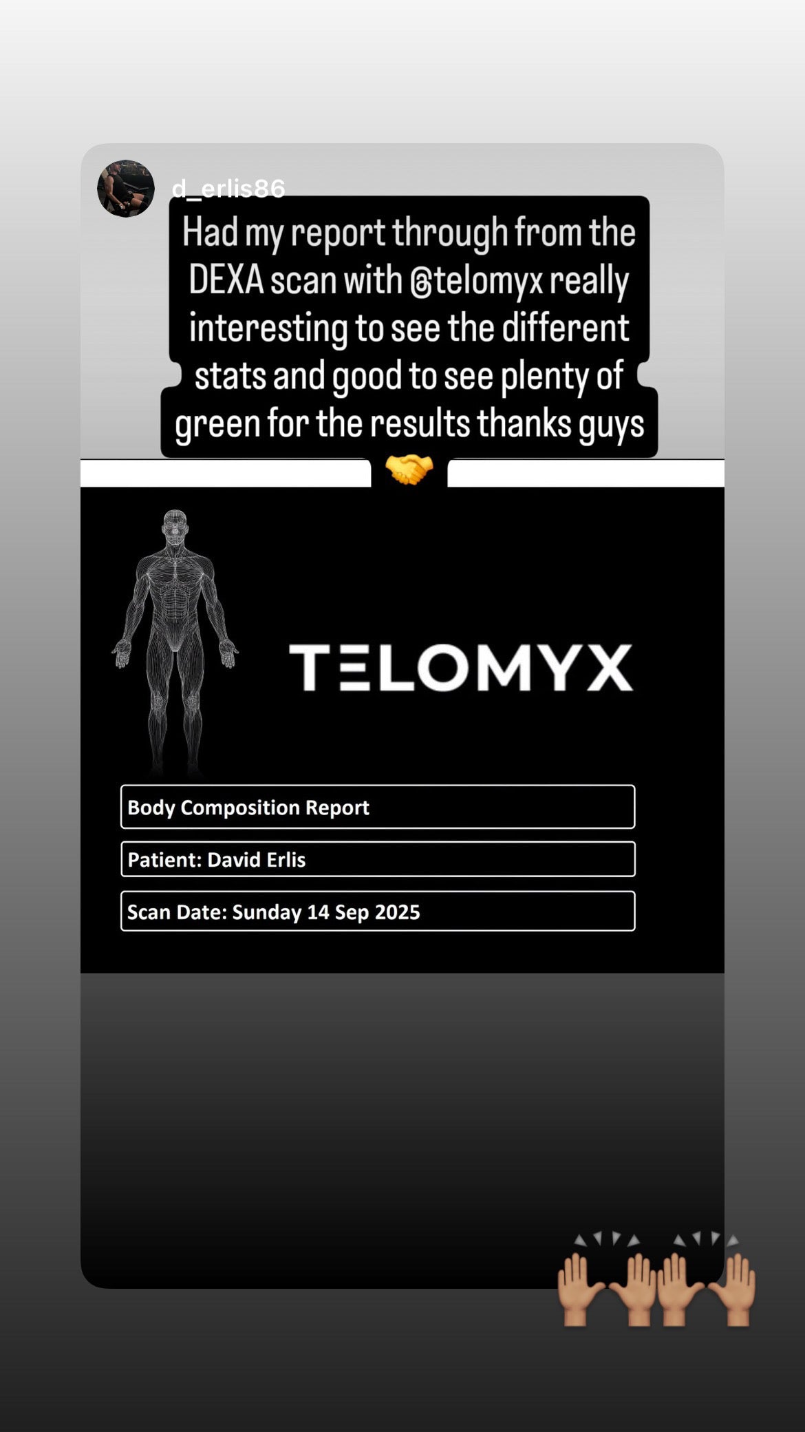 A happy customer posting on instagram about telomyx