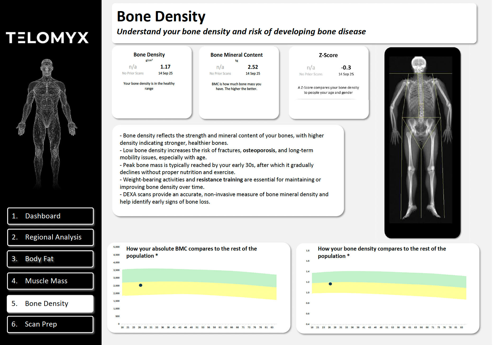 An image of the Bone Density section of the Telomyx DEXA report